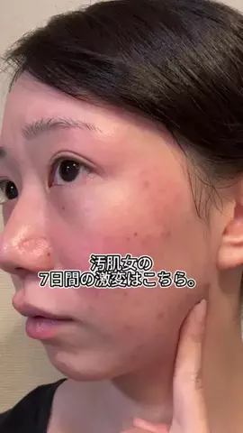 RumiiiのTikTok投稿