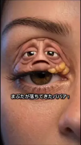 ニキビの本音のTikTok投稿