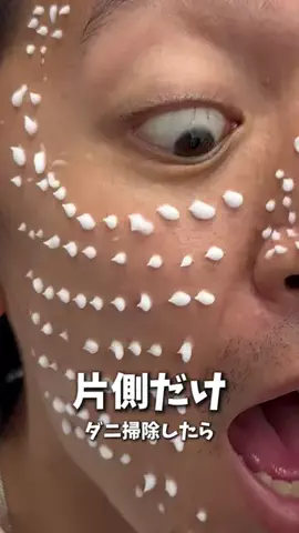 正直レビュー【メンズ美容】のTikTok投稿