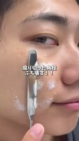 正直レビュー【メンズ美容】のTikTok投稿