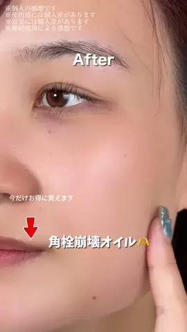ヒヨンのTikTok投稿
