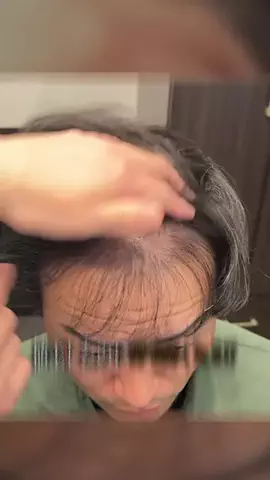 植毛美容師チャンネルのTikTok投稿