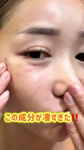 嬢のTikTok投稿