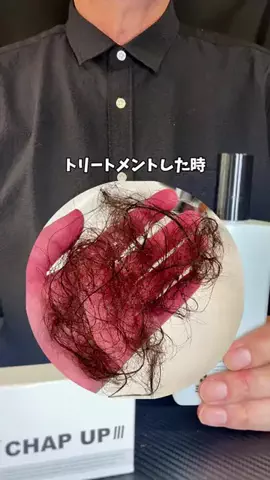 さくら🎀PDRN💝美容オタクのTikTok投稿