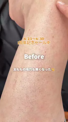 さくら🎀PDRN💝美容オタクのTikTok投稿