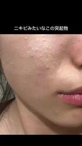 らら 🐹美容・垢抜けのTikTok投稿