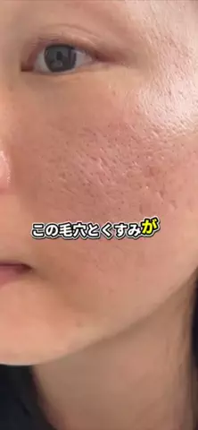 えま🧸美容ガチ勢のTikTok投稿