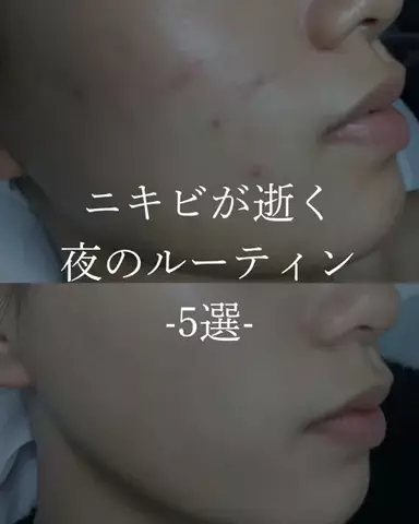 ダン|美容ガチレビューのTikTok投稿