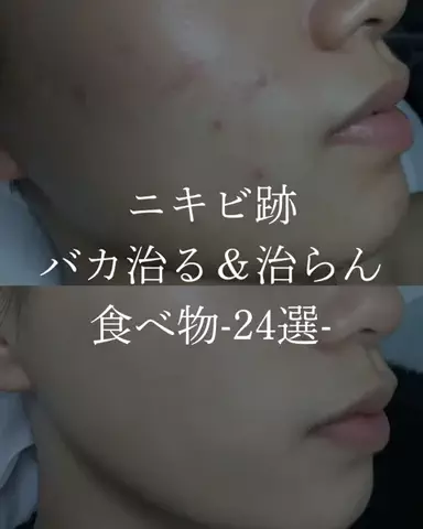 ダン|美容ガチレビューのTikTok投稿