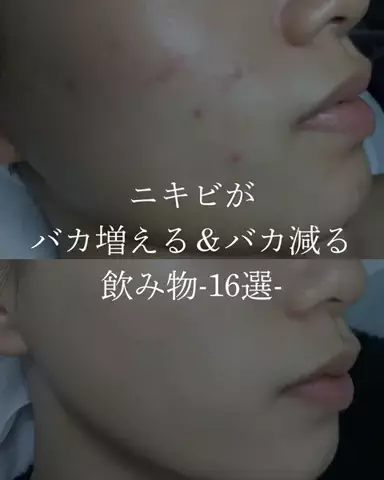 ダン|美容ガチレビューのTikTok投稿