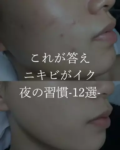 ダン|美容ガチレビューのTikTok投稿