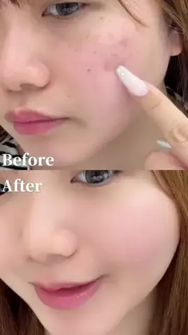 𝒎𝒂𝒊🤍美白ガチ勢のTikTok PR投稿：まいキャプション シミ対策はこれ一択✨ シミには高濃度…