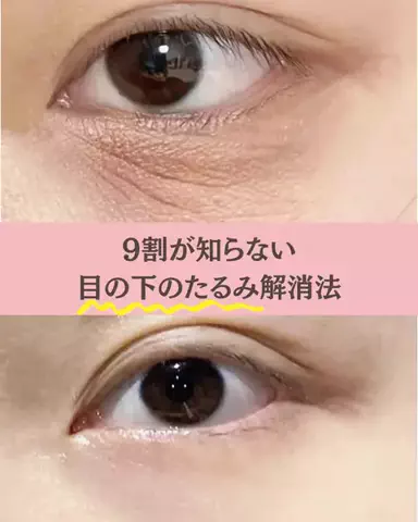 美容ﾈｷのTikTok投稿