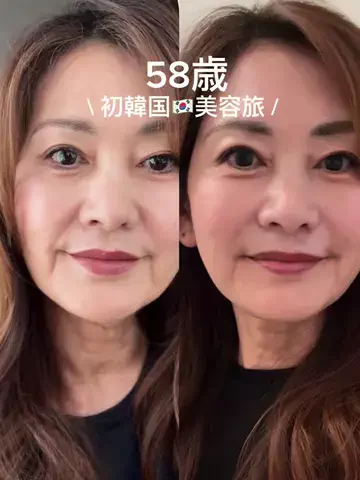 akubi/59歳bodymake/栄養コンシェルジュのTikTok投稿