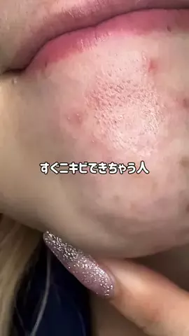 むくのTikTok投稿