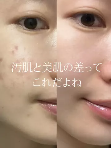 ひな | 美容ネキのTikTok投稿