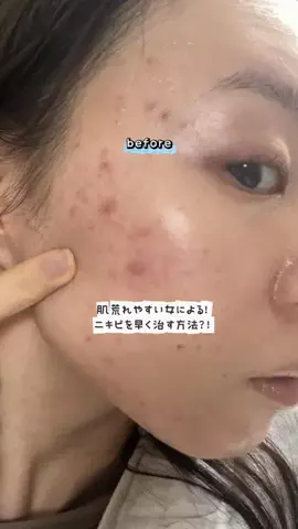 りょくにかちゃのTikTok投稿