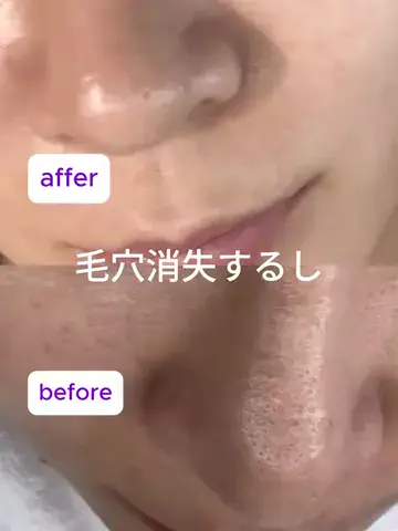 ゆうりん🌟のTikTok投稿