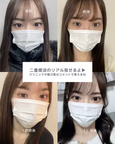 垢抜け日記ちゃんのTikTok投稿