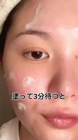ゆい〻美容クリニック勤務のTikTok投稿