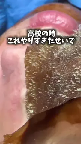 毛穴ちゃん🍓のTikTok投稿