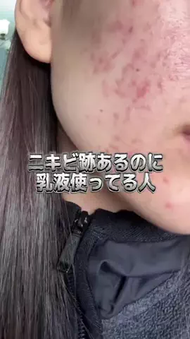 毛穴ちゃん🍓のTikTok投稿