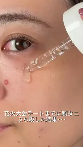 ヒイロのTikTok投稿