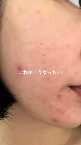 みなり￤いい女を目指すアラサーのTikTok投稿