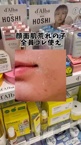 もも🐣垢抜けのTikTok投稿