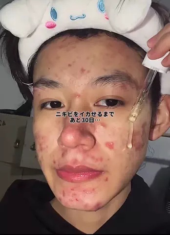夜野モテ男のTikTok投稿