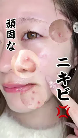 こんぷれちゃんのTikTok投稿