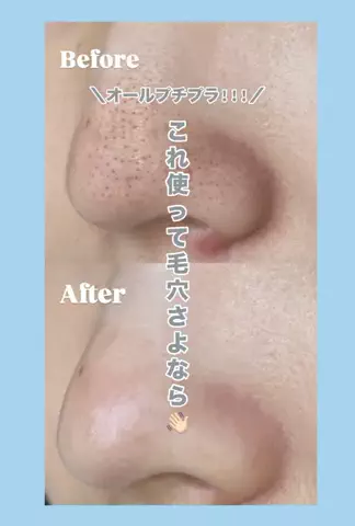 ポチャコの美容のTikTok投稿