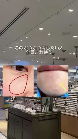 ななしのごんべちゃんのTikTok投稿