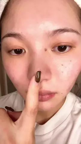 ゆい〻美容クリニック勤務のTikTok投稿