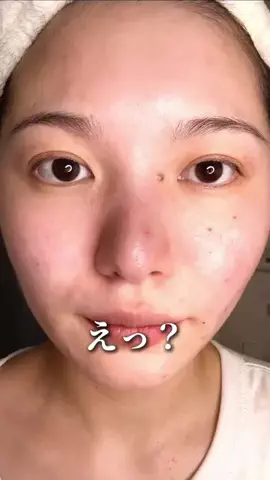 ゆい〻美容クリニック勤務のTikTok投稿