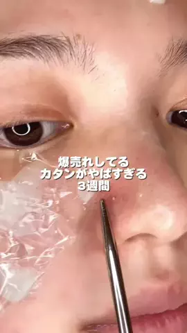 ゆい〻美容クリニック勤務のTikTok投稿