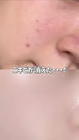 美容ネキ【本物】のTikTok投稿
