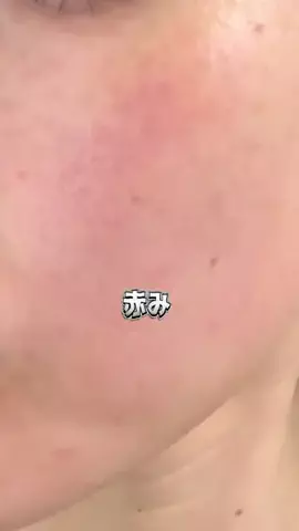 ぴか⌇美容好き限界ワーママのTikTok投稿