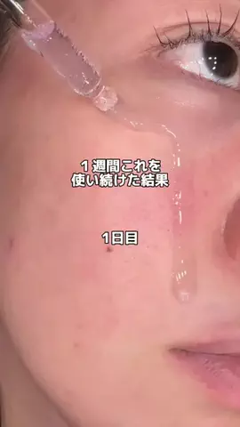 保湿警察のTikTok投稿