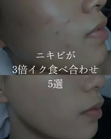 ダン|美容ガチレビューのTikTok投稿