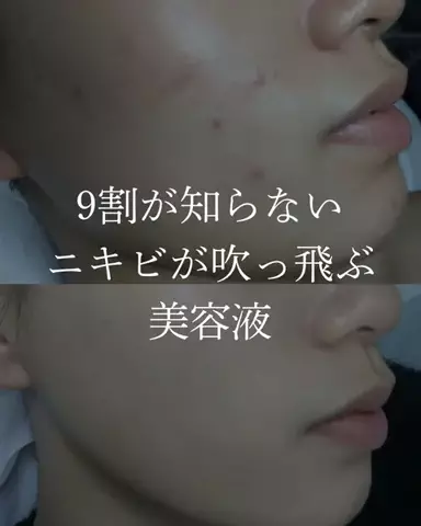 ダン|美容ガチレビューのTikTok投稿