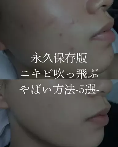 ダン|美容ガチレビューのTikTok投稿