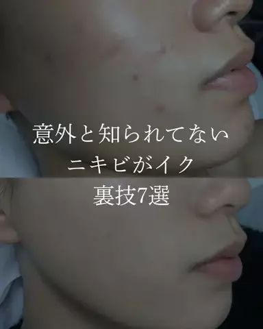 ダン|美容ガチレビューのTikTok投稿