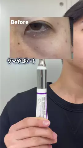 変身美容のTikTok投稿