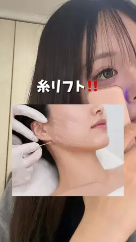 shiho@垢抜けのTikTok投稿