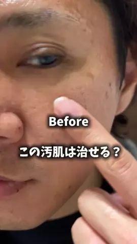 みなきメンズ美容のTikTok投稿