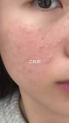 ブスモテ無双ちゃんのTikTok投稿