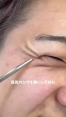 ガチ美容のTikTok投稿