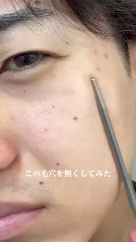 ガチ美容のTikTok投稿