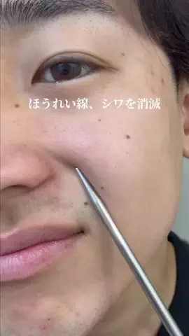 ガチ美容のTikTok投稿